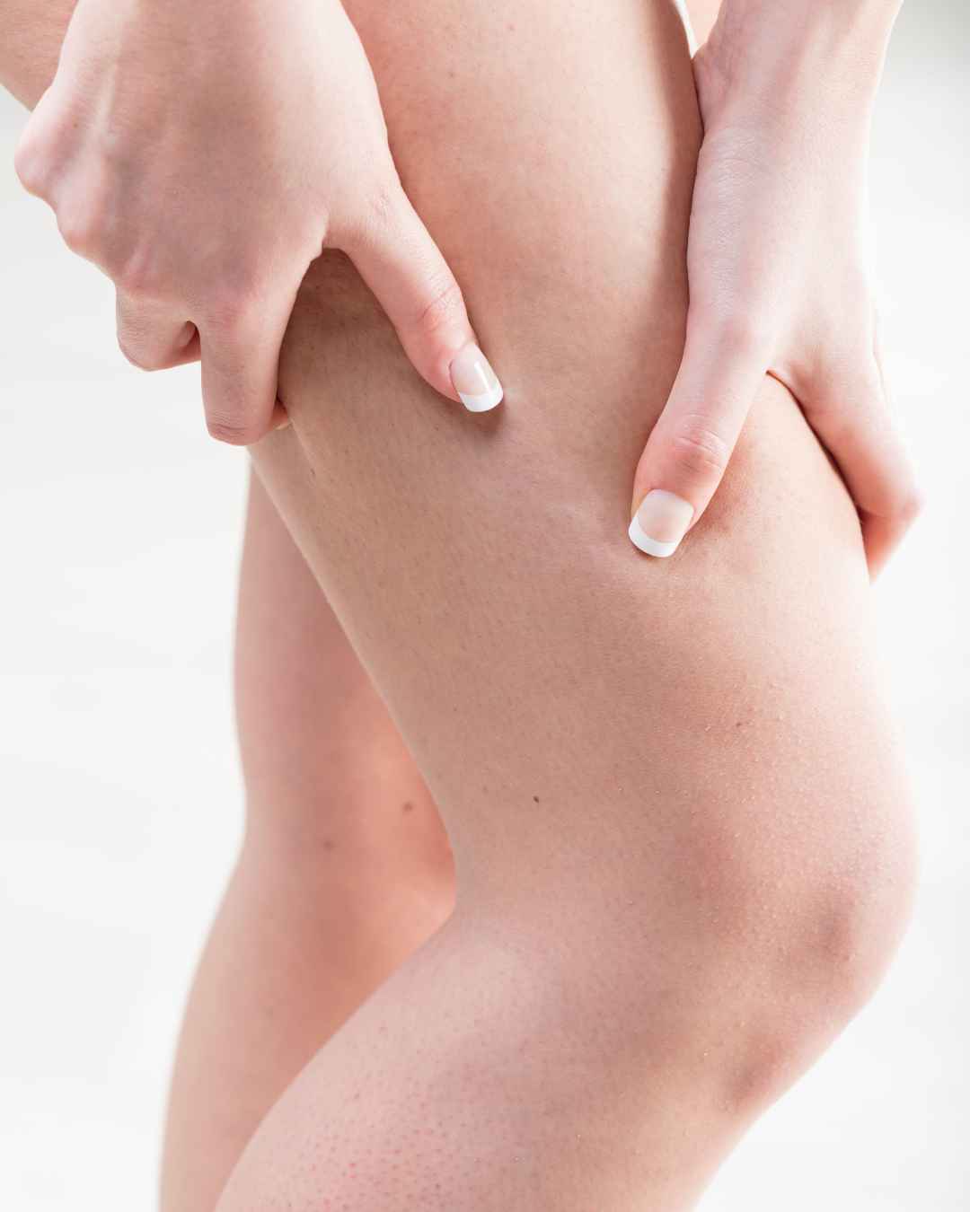 ritenzione idrica gambe Pelle a buccia d’arancia su gambe e cosce – inestetismi della cellulite trattabili con pressoterapia e trattamenti drenanti